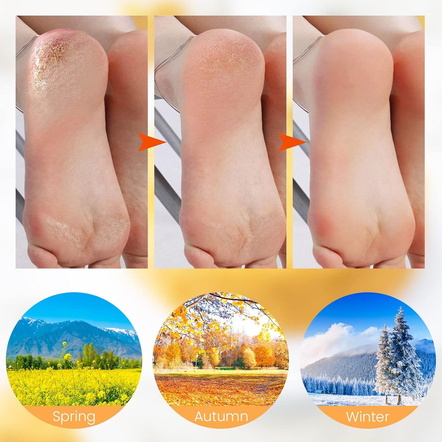 🔥Få 3 stycken för priset av 1!✨Njut av fotspa var som helst, när som helst!👣Fuktgivande fotmaskar, exfolierande silikonstrumpor